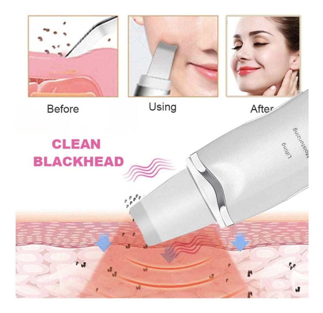 Hydrafacial+ Skin Scrubber Puntos Negros Hidrata Piel
