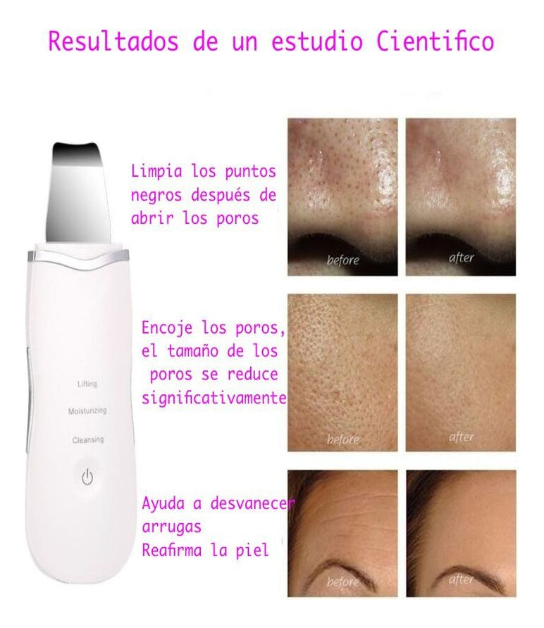 Hydrafacial+ Skin Scrubber Puntos Negros Hidrata Piel