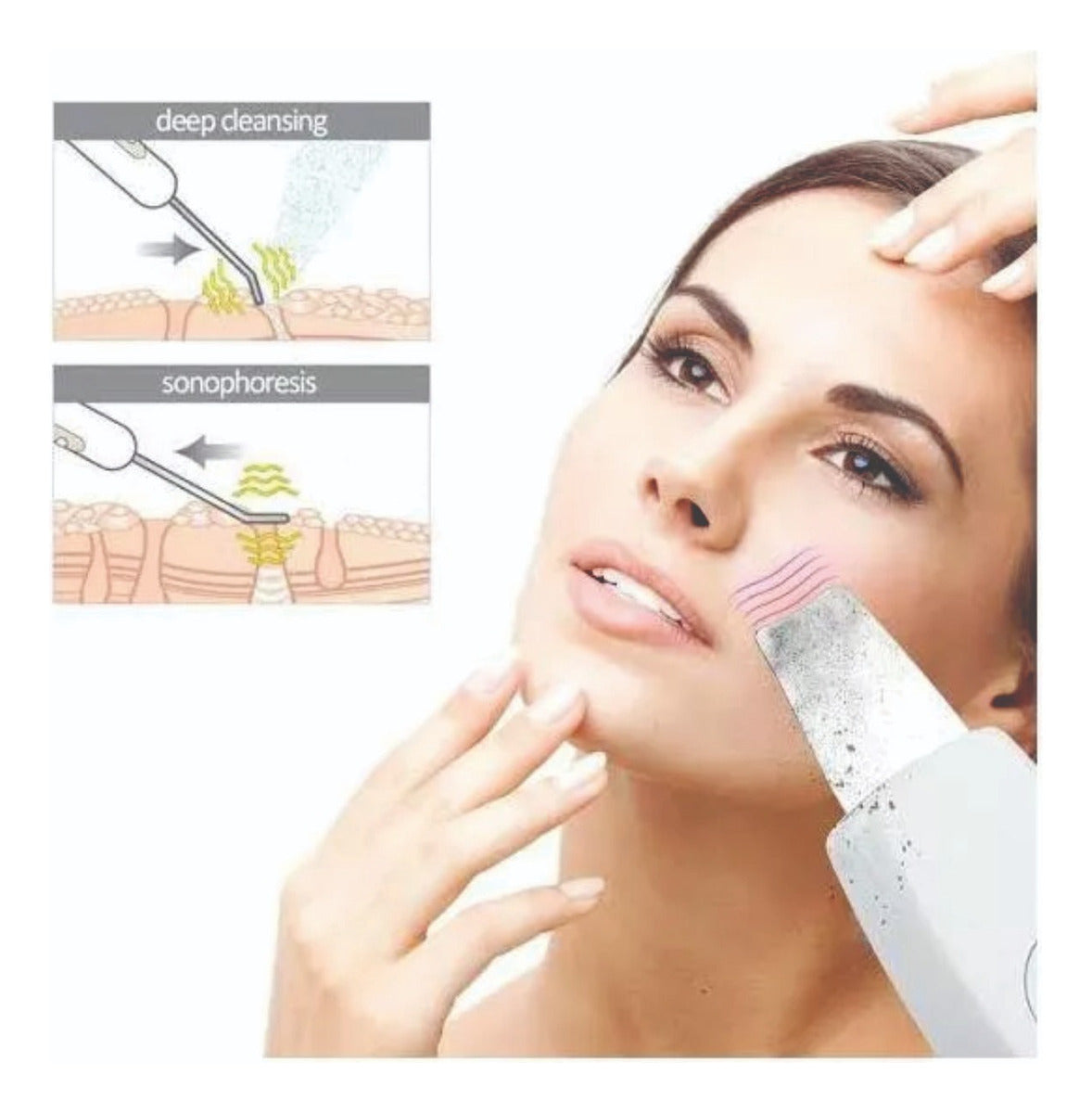Hydrafacial+ Skin Scrubber Puntos Negros Hidrata Piel