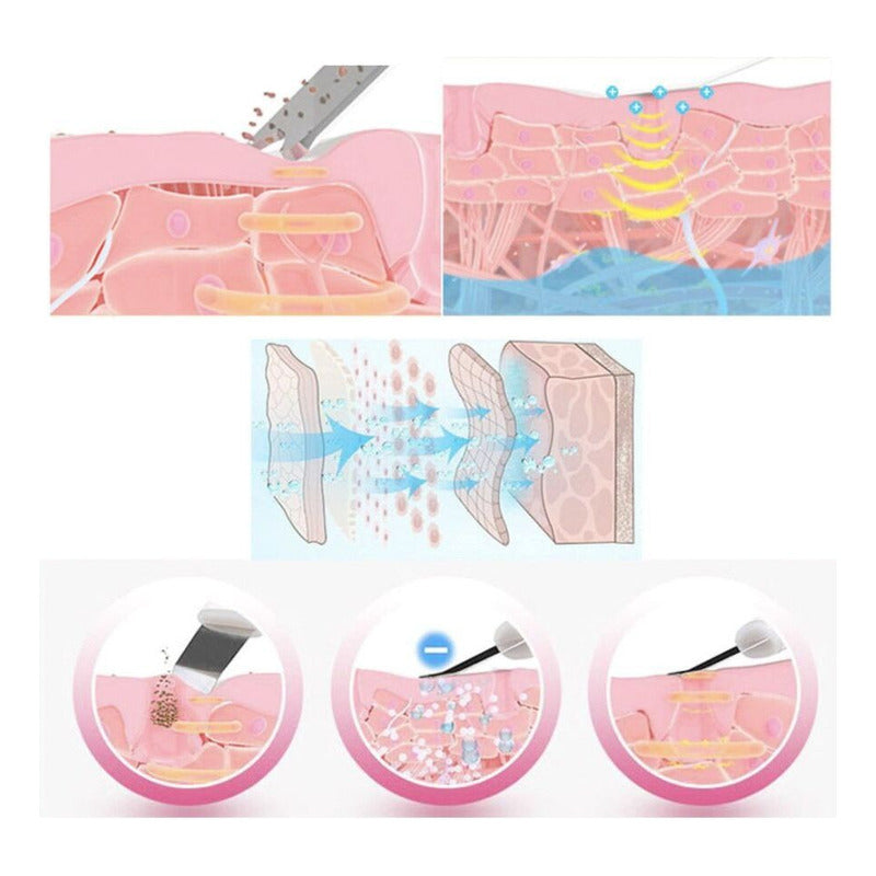 Hidrafacial Hidrodermobrasion+ Skin Scrubber+ Sacacomedones Todo Tipo De Piel Día/noche