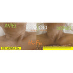 Maquina Reafirmante Linfting Rejuvenecimiento Mini Hifu