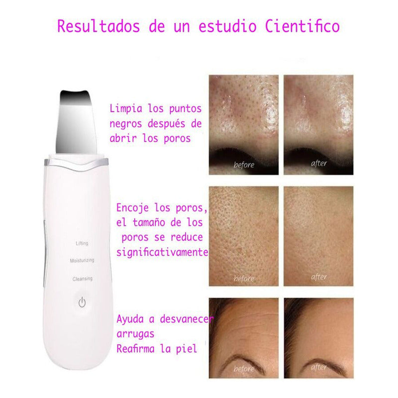 Hidrafacial Hidrodermobrasion+ Skin Scrubber+ Sacacomedones Todo Tipo De Piel Día/noche