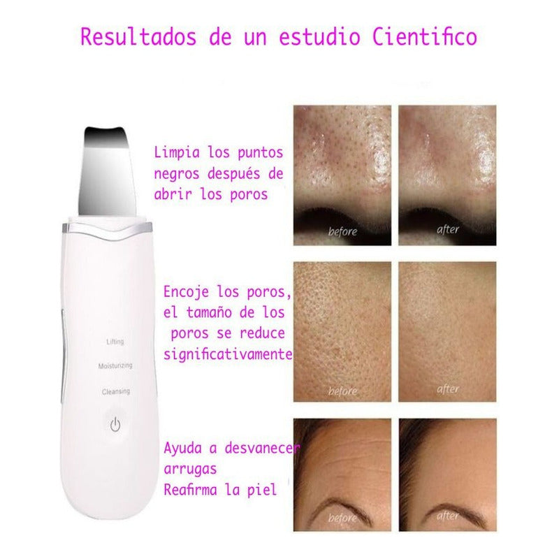 Limpiador Facial Skin Scrubber+sacacomedones Skin Care Acne Blanco