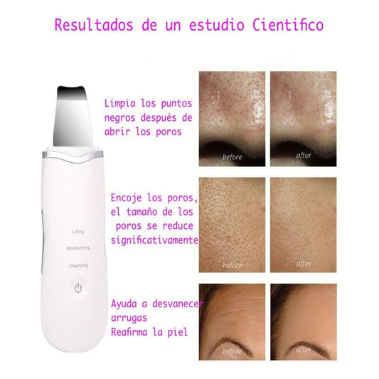 Limpiador Facial Skin Scrubber+sacacomedones Skin Care Acne Blanco
