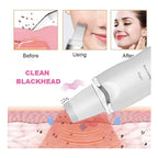 Limpiador Facial Skin Scrubber+sacacomedones Skin Care Acne Blanco