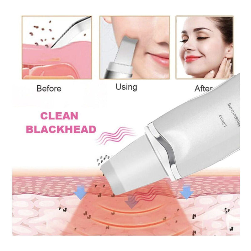 Limpiador Facial Skin Scrubber+sacacomedones Skin Care Acne Blanco