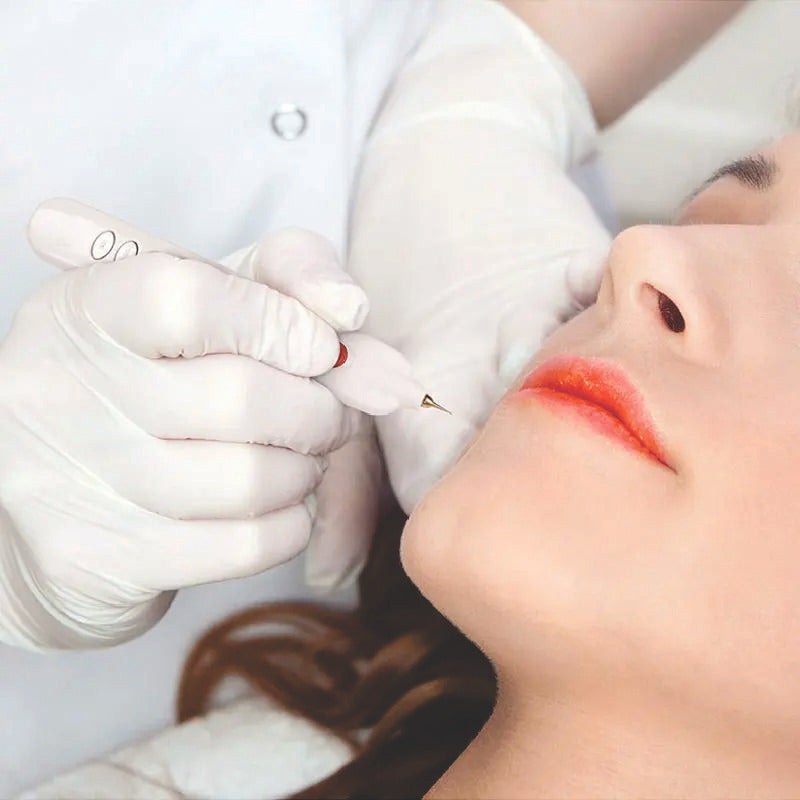 Plasmapen Fibroblast Elimina Tatuaje Verruga Mezquino Mancha