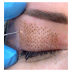 Plasma Pen Fibroblast + 8 Puntas Reafirma Liting Arrugas