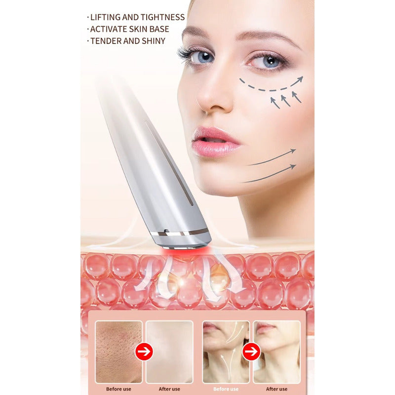 Rejuvenecimiento Facial Antiarrugas Lifting Rf Ems Led 4 En1