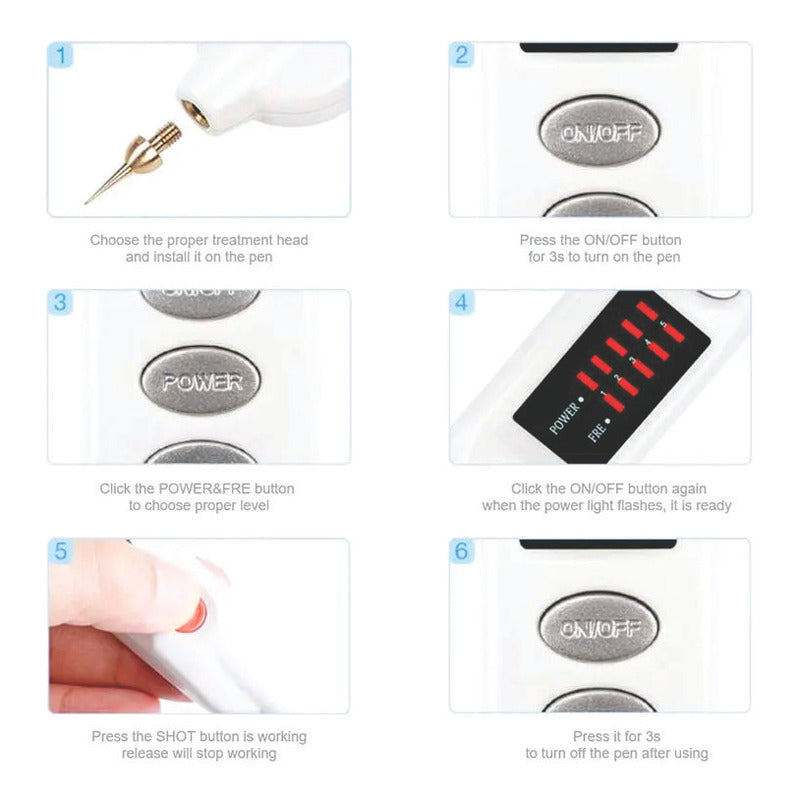 Plasmapen Fibroblast Elimina Tatuaje Verruga Mezquino Mancha