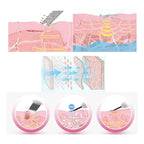 Limpiador Facial Skin Scrubber+sacacomedones Skin Care Acne Blanco