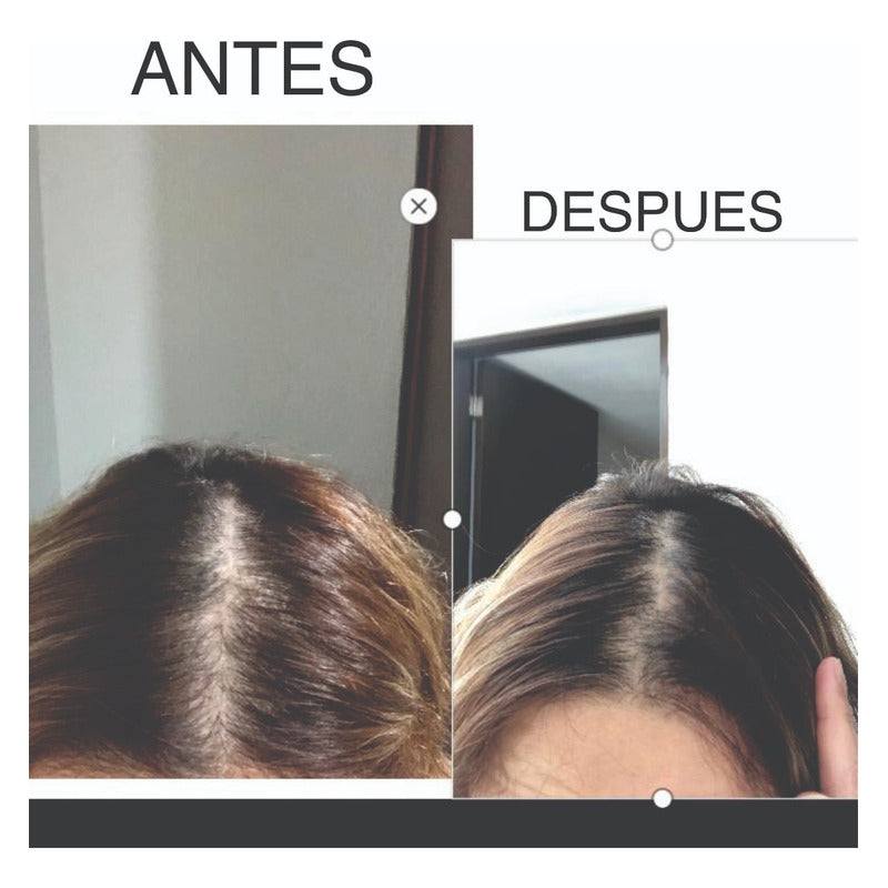 Crecimiento De Cabello Peine Láser Caida Cepillo Masajeador Blanco