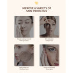 Rejuvenecimiento Facial Antiarrugas Lifting Rf Ems Led 4 En1