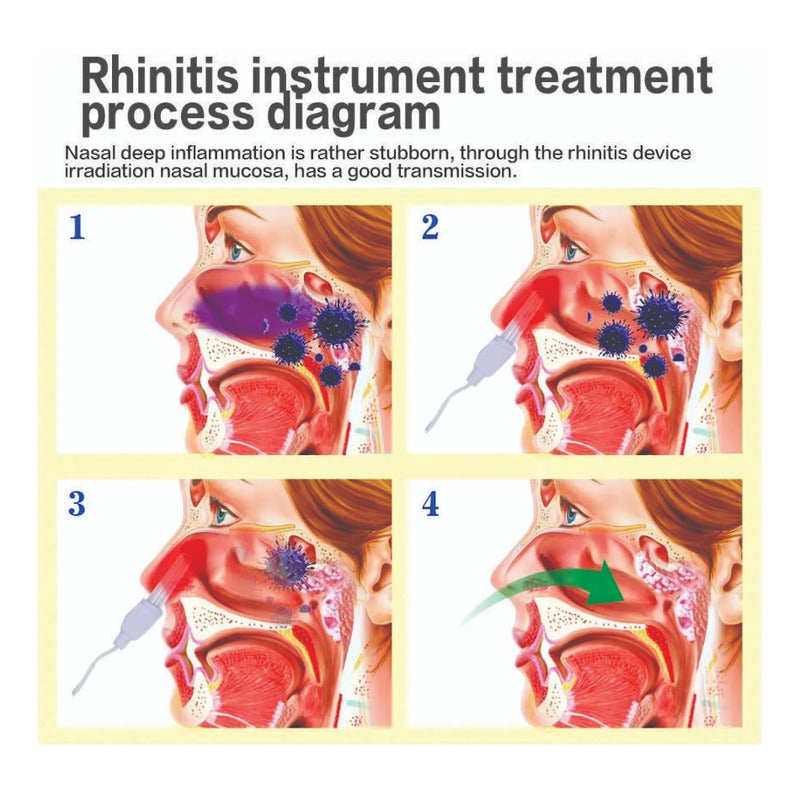 Laser  Terapia Rinitis Alergias Adulto/niño  Envio Gratis