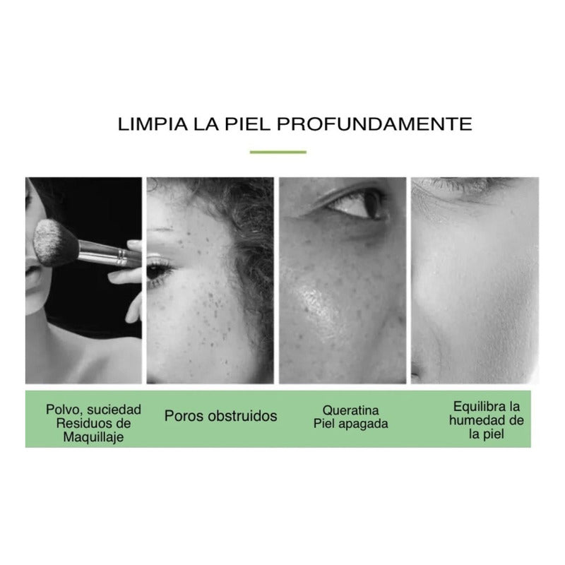 Limpiador Hidrafacial Hidrodermoabrasion Poros Puntos Negros