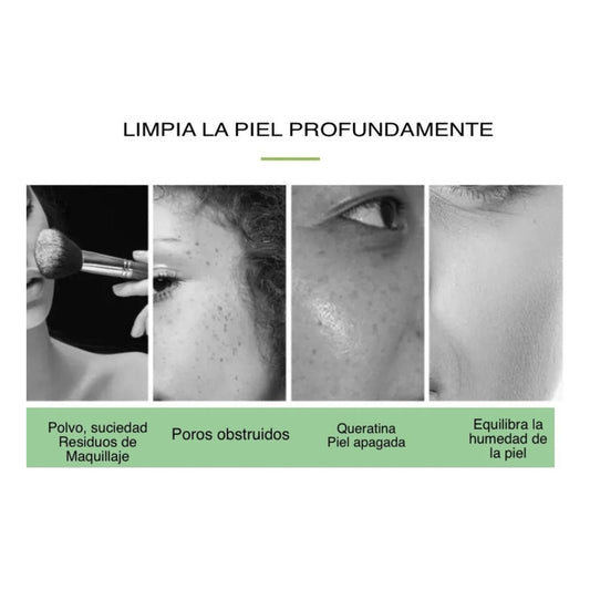 Limpiador Hidrafacial Hidrodermoabrasion Poros Puntos Negros