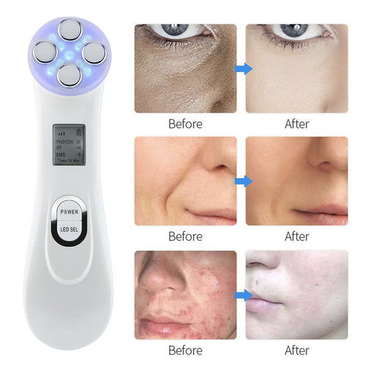 Máquina  Facial Ems+ Reafirmante+led +electroporador Arrugas