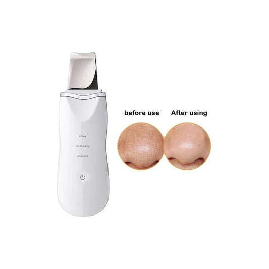 Limpiador Facial Peeling Ultrasónico Portatil Skin Scrubber