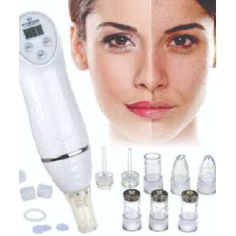 Microdermoabrasión Punta De Diamante Portátil Peeling