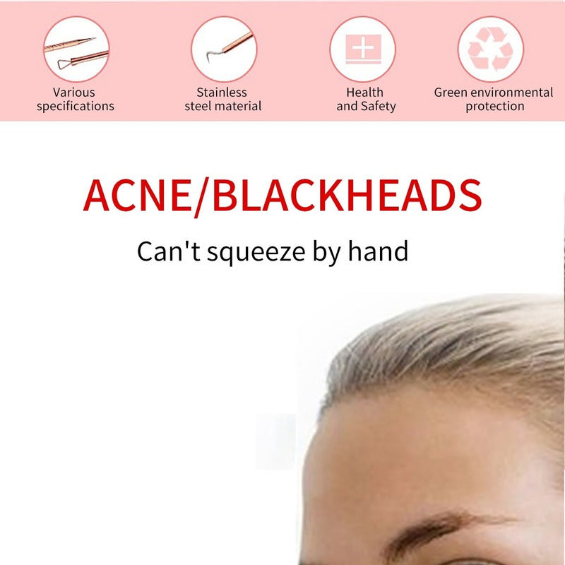Kit Sacacomedones Remover Espinillas Y Puntos Negros 4 Pzas