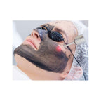 Lentes De Proteccion Ipl, Laser, Yag ,shr + Googles Rojo