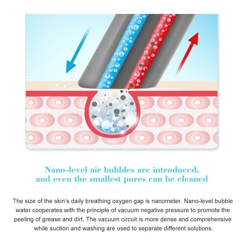 Hidrodermoabrasión Removedor De Espinillas, Puntos Negros