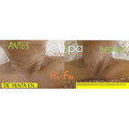 Minihifu Facial Corporal+masajeado Cuello Papada Lifting+gel