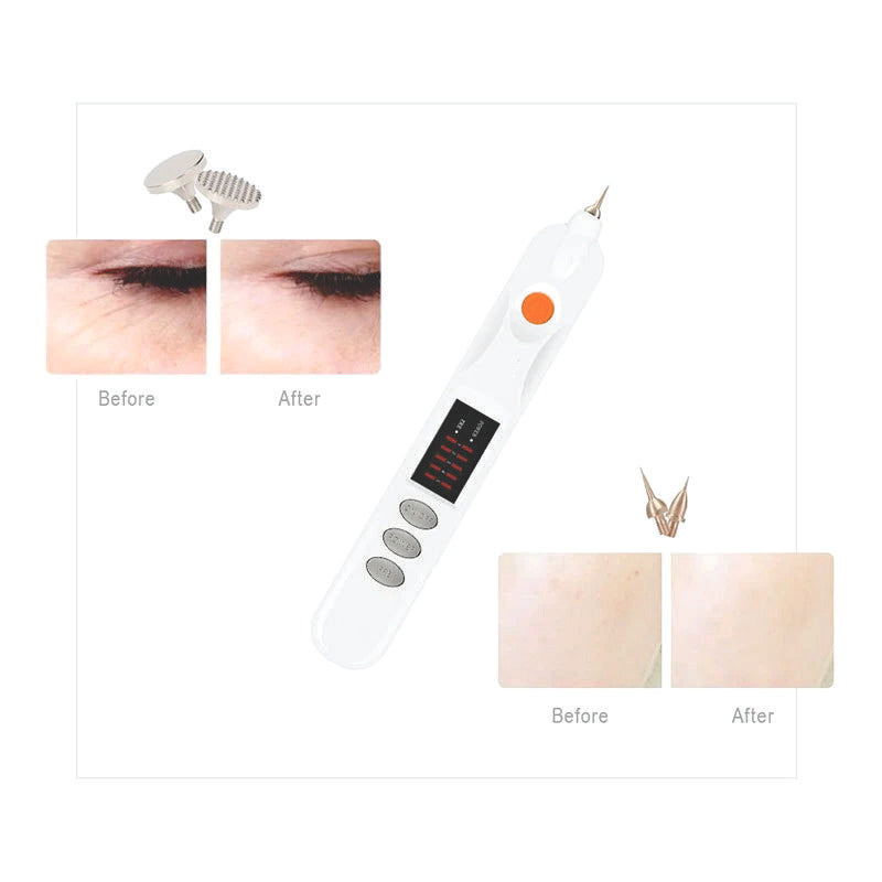 Plasmapen Fibroblast Elimina Tatuaje Verruga Mezquino Mancha