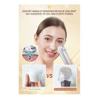 Rejuvenecimiento Facial Antiarrugas Lifting Rf Ems Led 4 En1