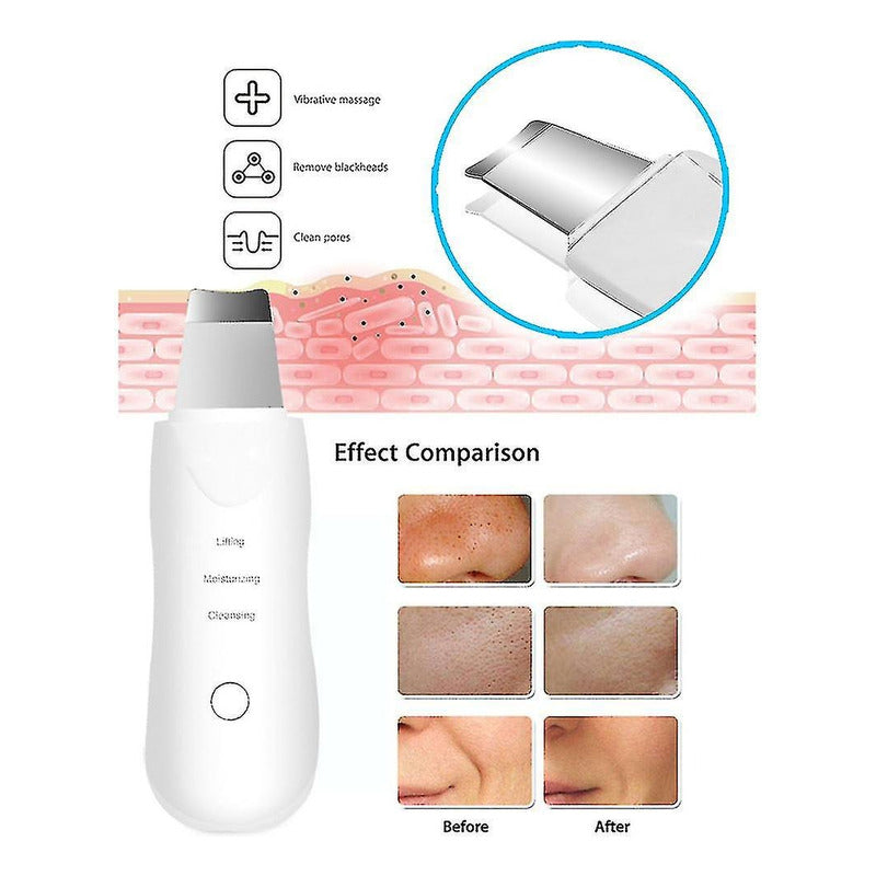 Limpiador Facial Peeling Ultrasónico Portatil Skin Scrubber