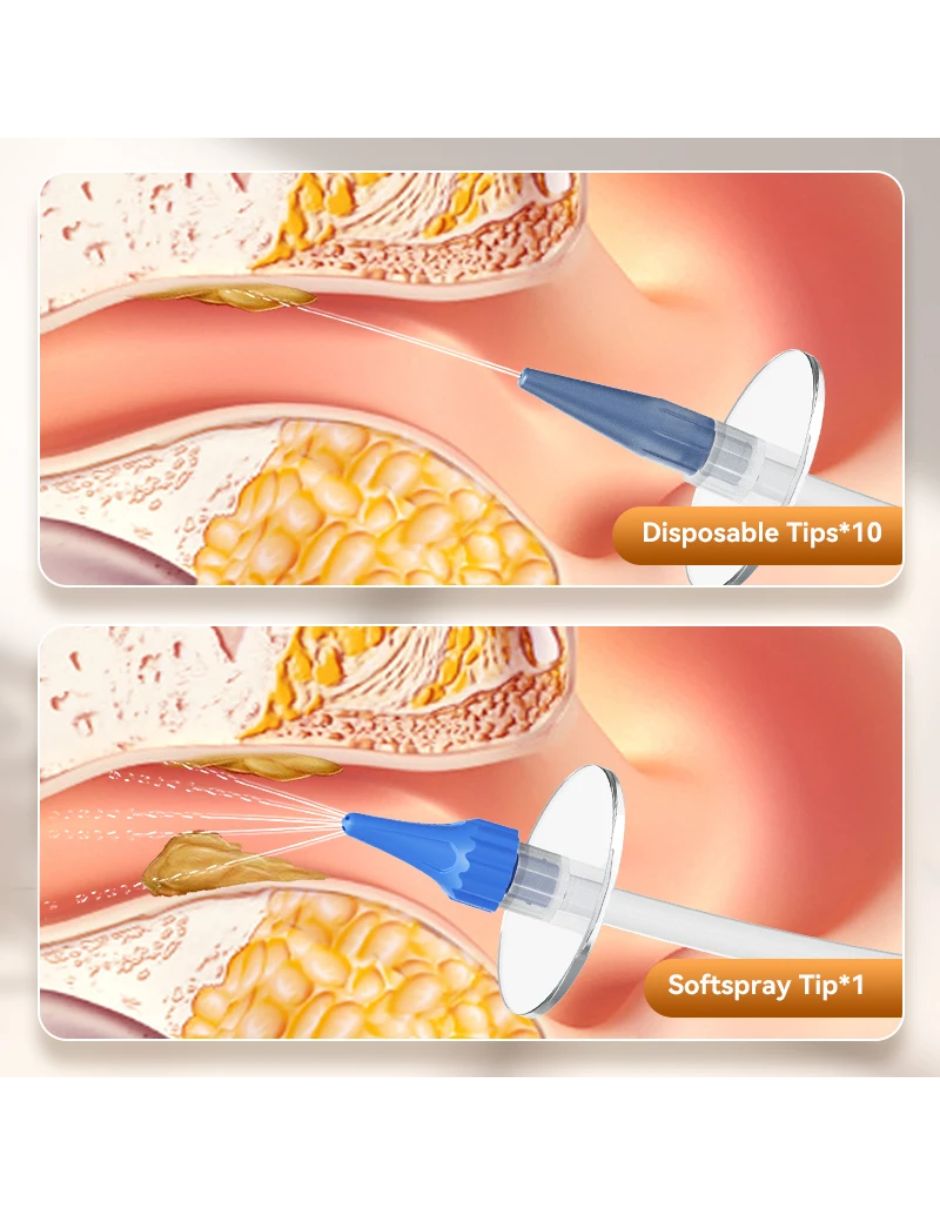 Kit Limpieza Oidos Remueve Cerilla  Lavado Orejas Otitis