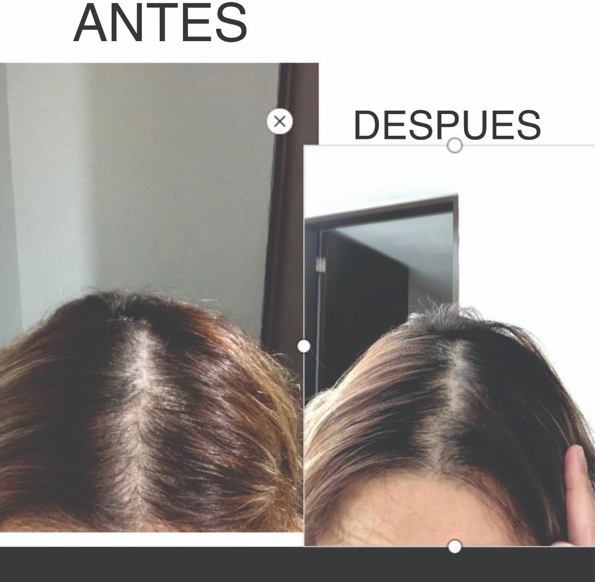 Peine Cepillo Regenera Crecimiento Cabello Anti Caida Alopec