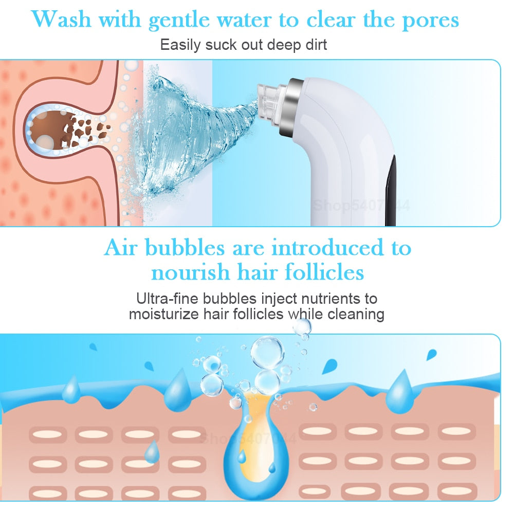 Hidrafacial Hidrodermobrasion+ Skin Scrubber+ Sacacomedones Todo Tipo De Piel Día/noche