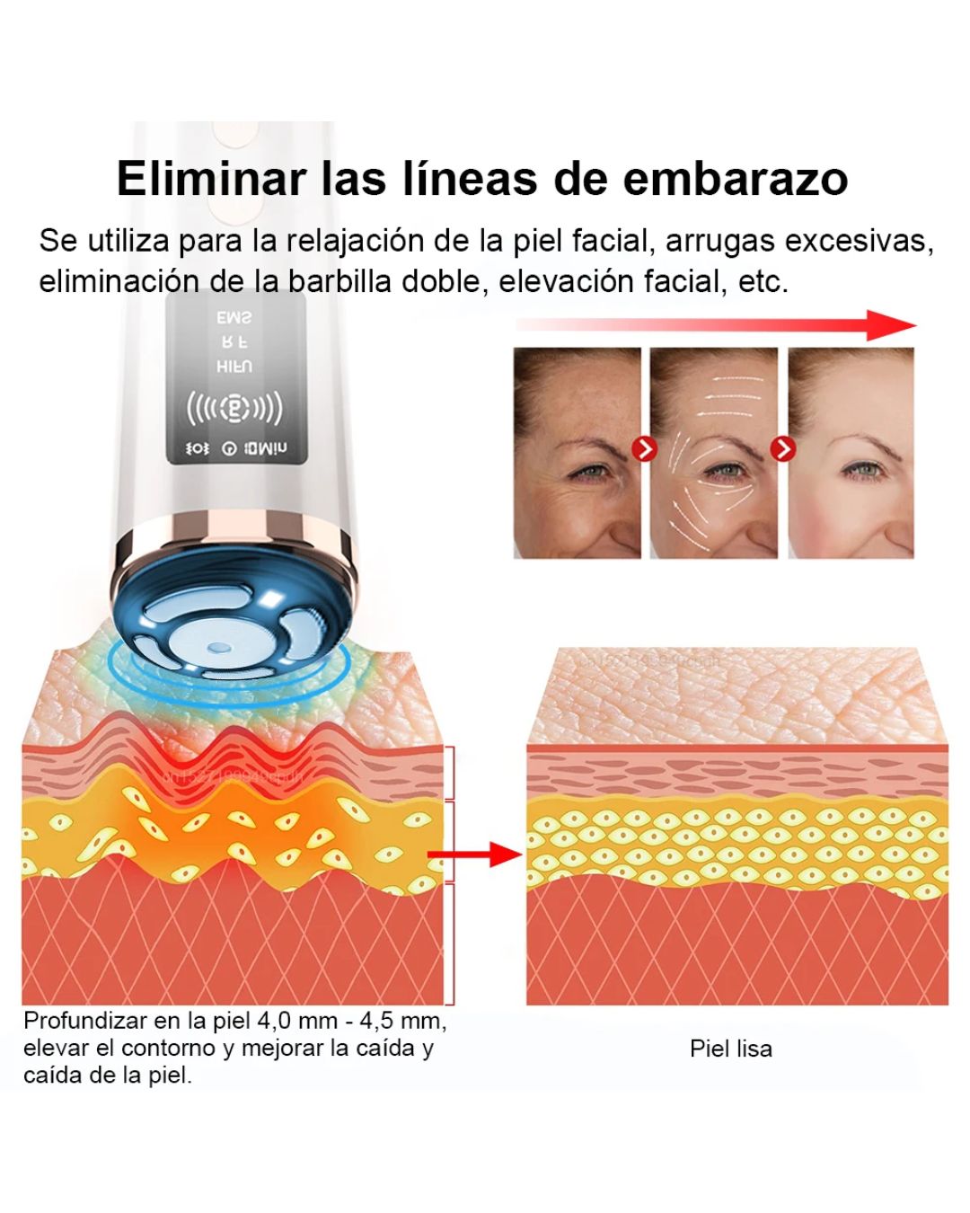 Rejuvenecimient Facial Antiarrugas Lifting Rf Ems Led 4 En 1