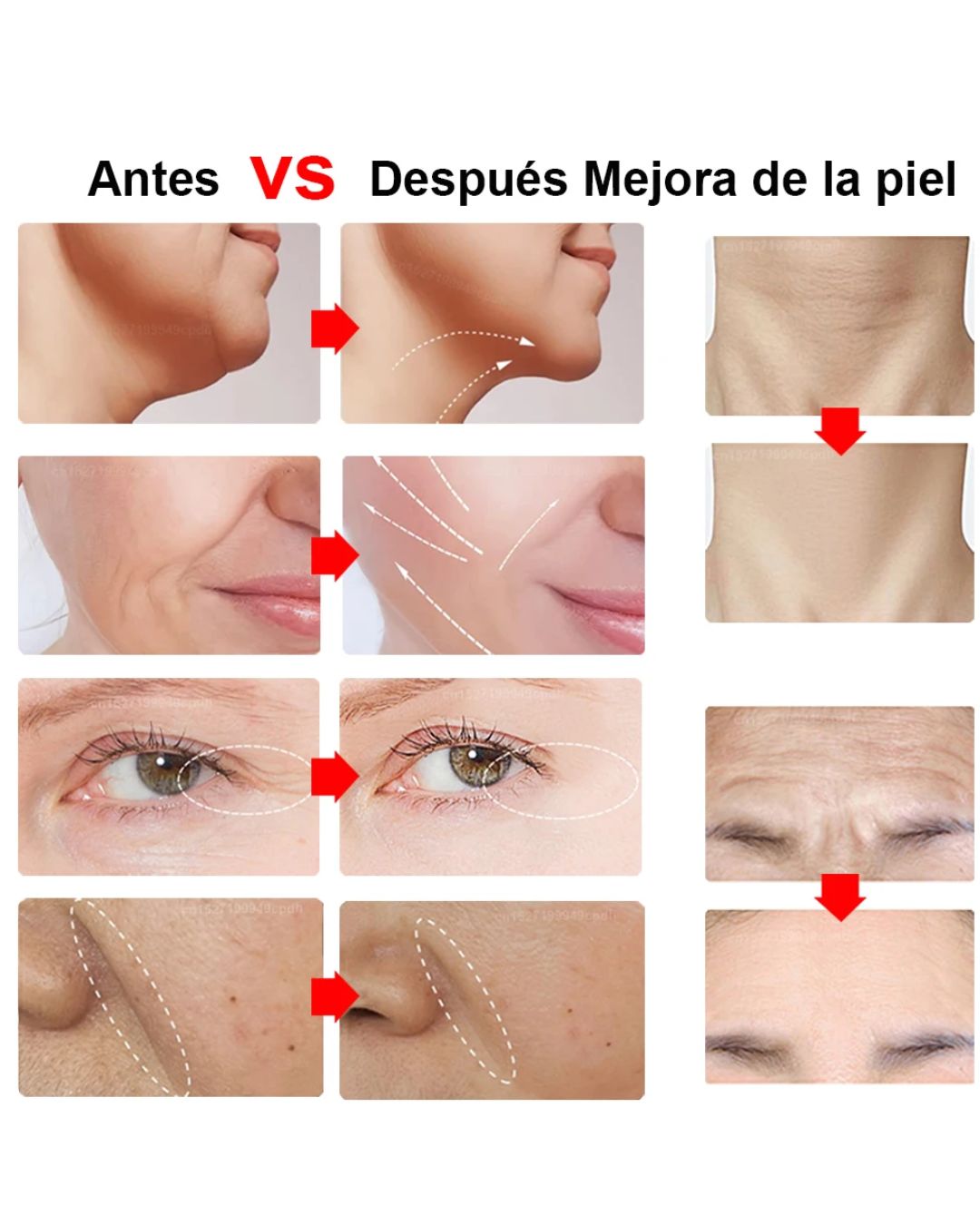 Rejuvenecimient Facial Antiarrugas Lifting Rf Ems Led 4 En 1