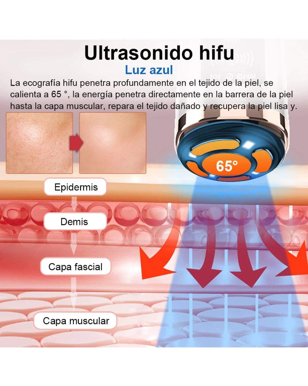 Rejuvenecimient Facial Antiarrugas Lifting Rf Ems Led 4 En 1