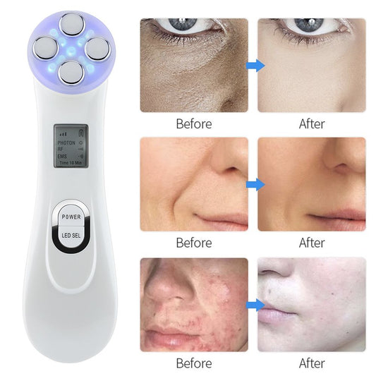 Skin Scrubber+vapor+radiofrecuencia Kit Facial Envio Gratis