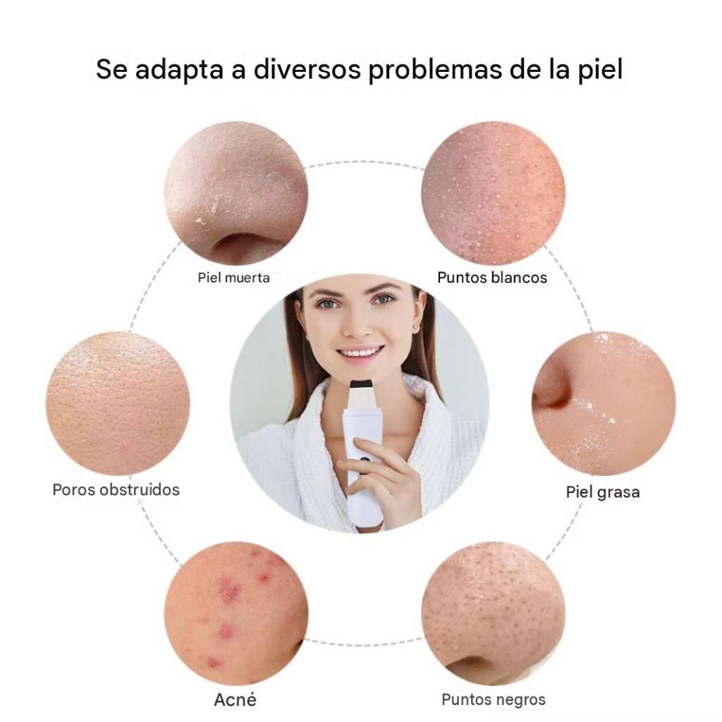 Limpiador Facial Peeling Ultrasónico Portatil Skin Scrubber